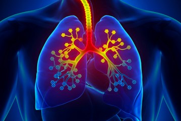 Upala dušnika – bronhitis, bronhalni katar