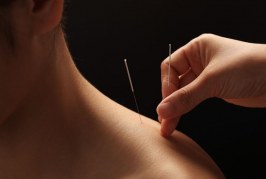 Šta treba da znate o akupunkturi?